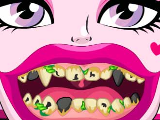 0/1335514535d5691b65985d50fdc463bc4906c1/draculaura-bad-teeth.jpg
